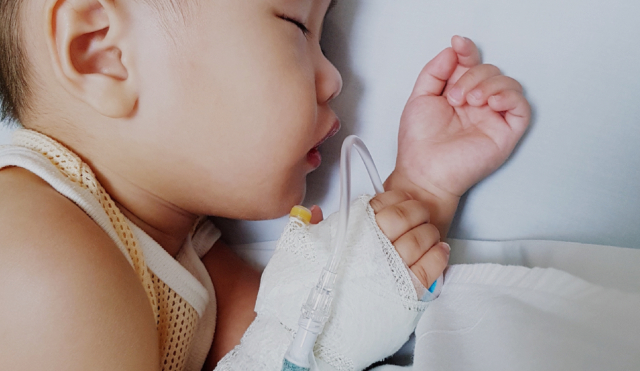 Image of baby sleeping with IV